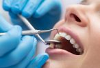 Finding the Right Dental Malpractice Lawyers New Jersey