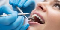 Finding the Right Dental Malpractice Lawyers New Jersey